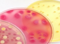 Ảnh hưởng của sự phát triển của vi sinh vật đối với nhũ tương polyme